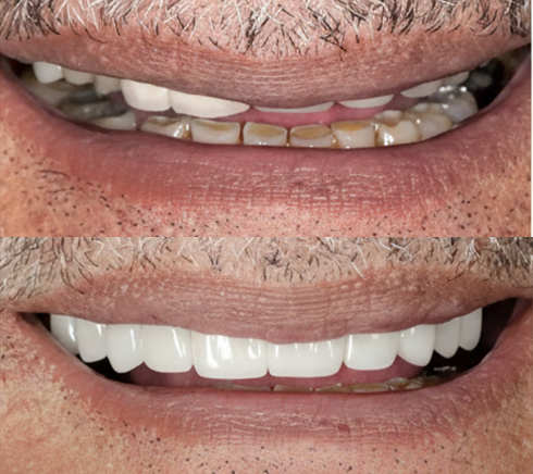 Before After