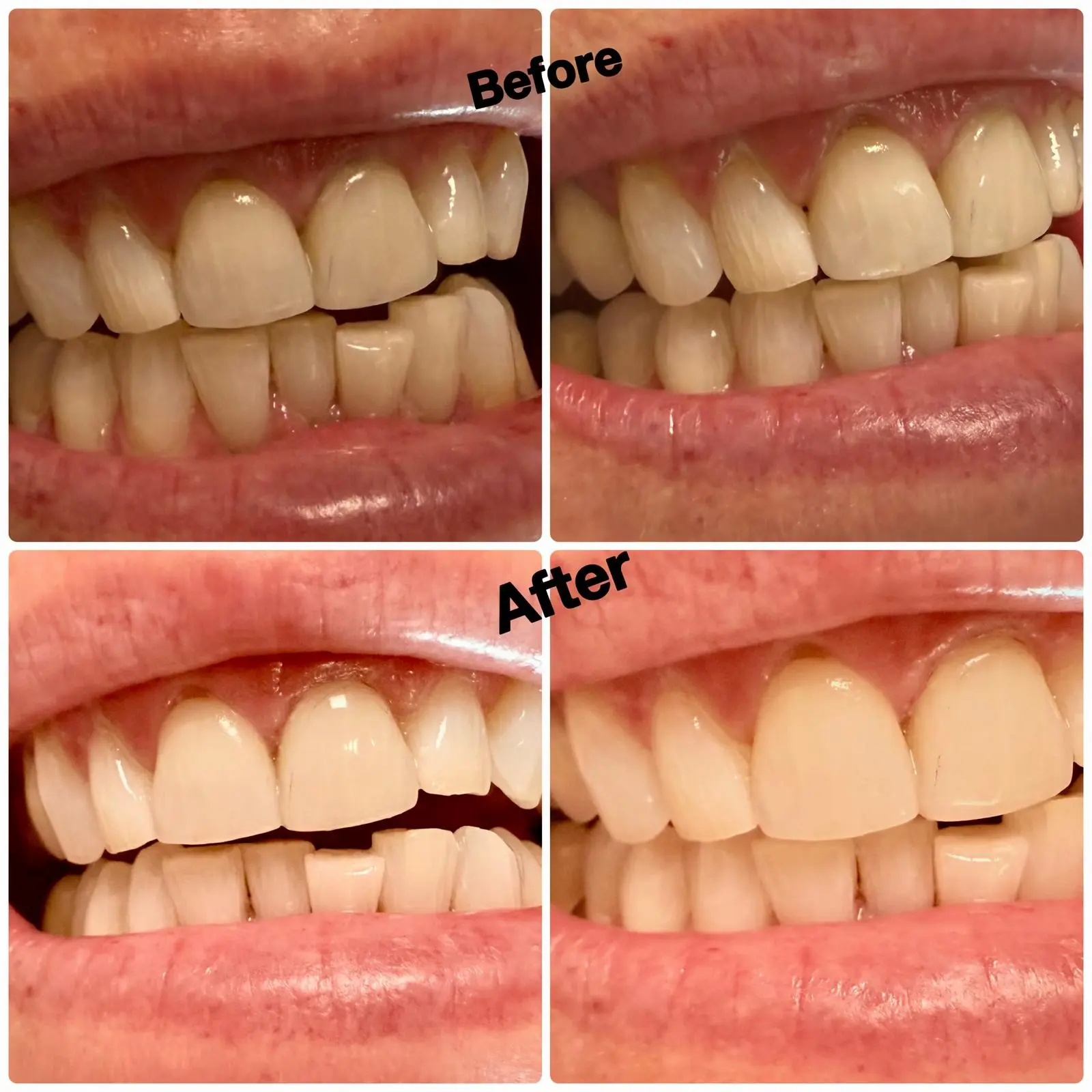 Before After