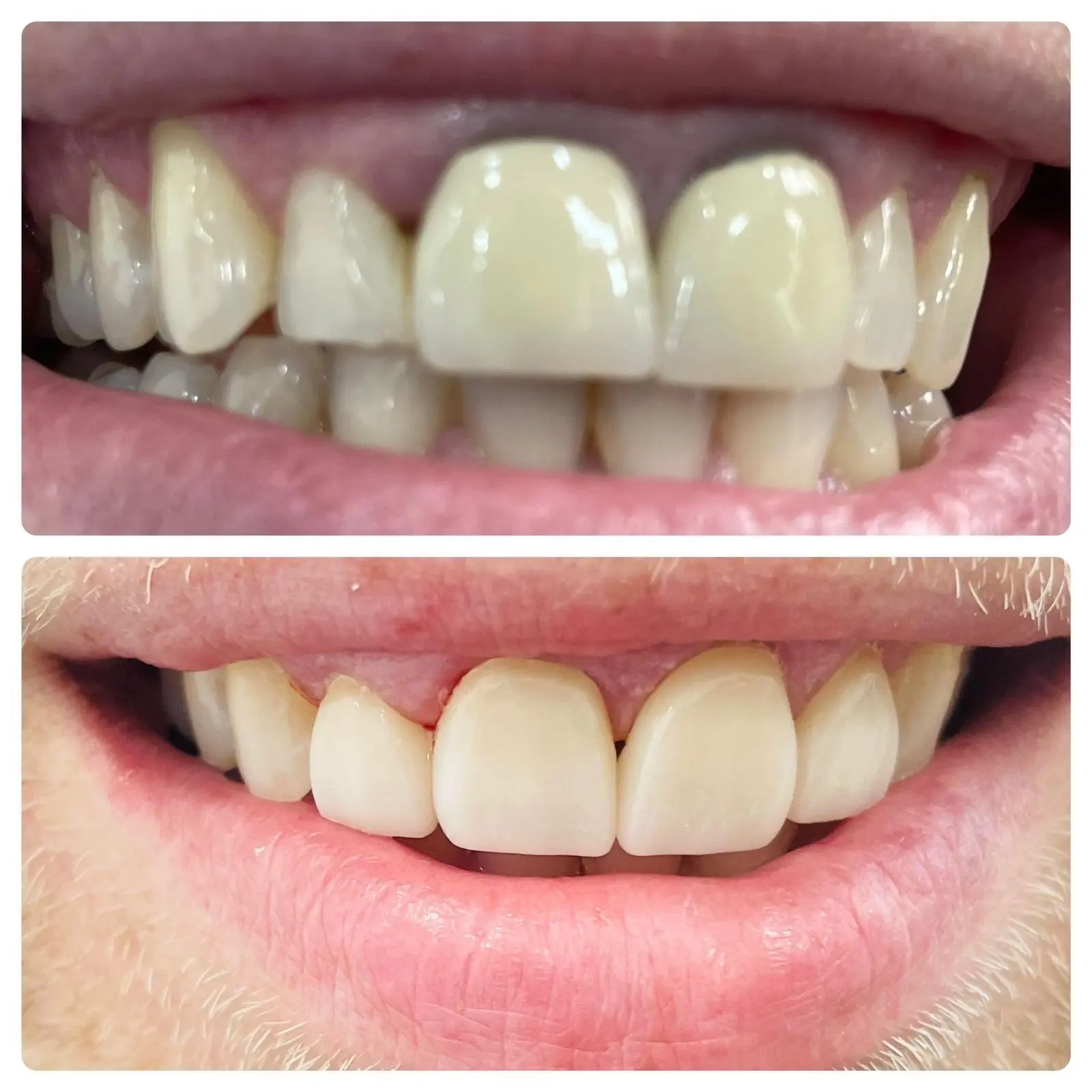 Before After