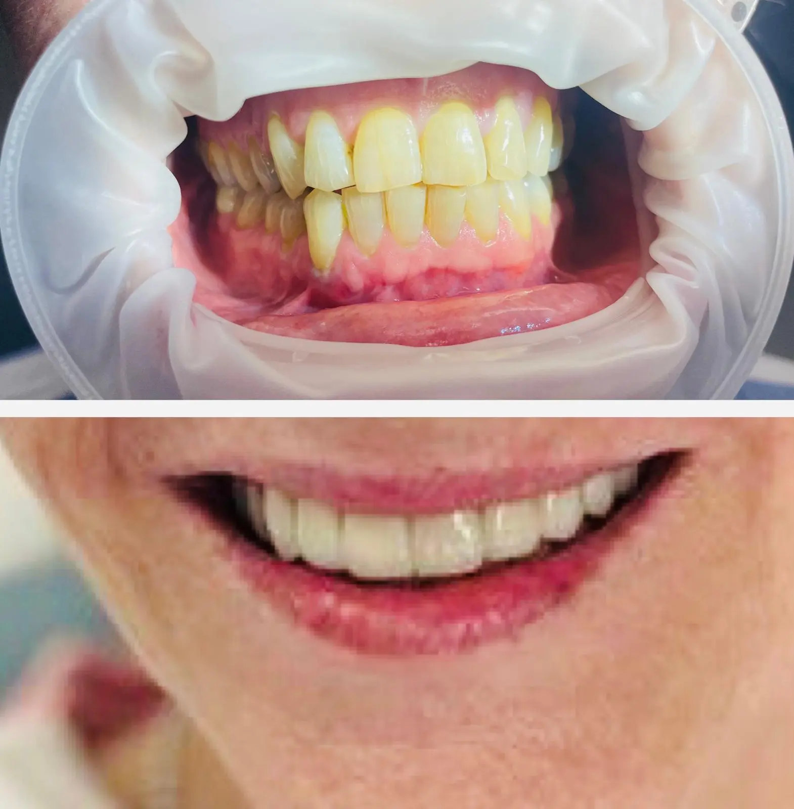 Before After