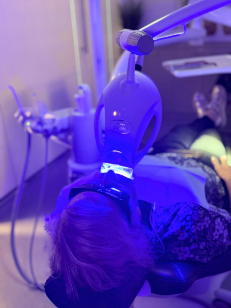 Whitening & Aesthetic Finishing